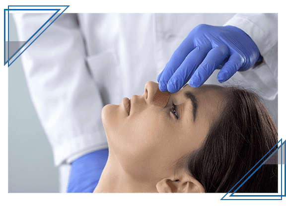 Symptoms of Sinus Headaches in Thousand Oaks, CA